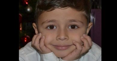 9 vjeçarit nga Prizreni, Benjamin Beqirit i duhet ndihmë financiare për shërim