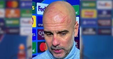 “Doja të lëndoja veten…” – Guardiola me gërvishtje në kokë dhe hundë pas ndeshjes ndaj Feyenoordit