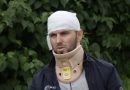 “Dy persona me motoçikletë dhe me helmeta”, policia jep detaje për të dyshuarit që e sulmuan Liridon Osmanin