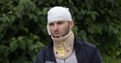“Dy persona me motoçikletë dhe me helmeta”, policia jep detaje për të dyshuarit që e sulmuan Liridon Osmanin