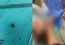 5 vjeçarit i shpëtohet pasi përbiu farën e paqëruar të lulediellit
