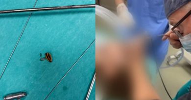 5 vjeçarit i shpëtohet pasi përbiu farën e paqëruar të lulediellit