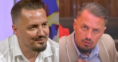 Ky është ndryshimi i Bleros pas botox-it: Krejt ata yjet e bojnë, s’jam veç unë