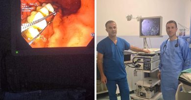 E pazakontë: Mjeku kosovar nxjerr protezën e dhëmbëve nga lukthi i një pacienti