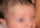 Është vetëm 2 muajshe, Vera ka nevojë që ta shpëtojë shikimin dhe jetën