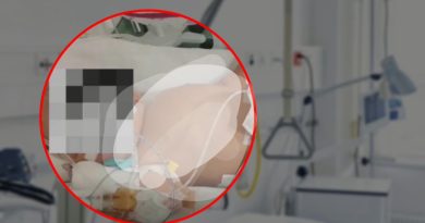 Vogëlushi nga Skënderaj ka nevojë urgjente për operim jashtë vendit